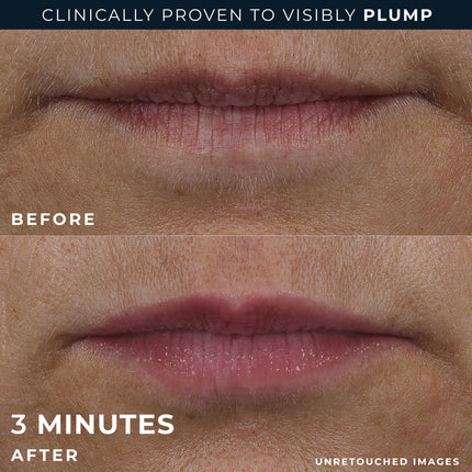 RoC Derm Correxion Lip Volumizer